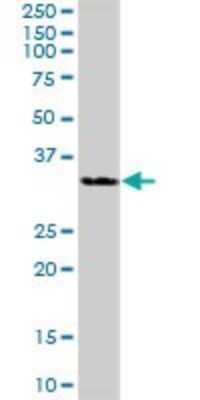 Western Blot: 11 beta-HSD1 Antibody [H00003290-B01P] - Analysis of HSD11B1 expression in human liver.