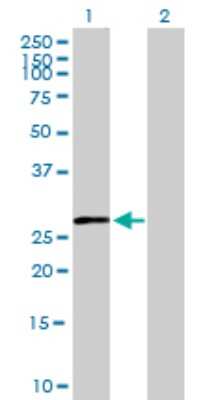 Western Blot: 11 beta-HSD1 Antibody [H00003290-B01P] - Analysis of HSD11B1 expression in transfected 293T cell line by HSD11B1 polyclonal antibody.  Lane 1: HSD11B1 transfected lysate(32.12 KDa). Lane 2: Non-transfected lysate.