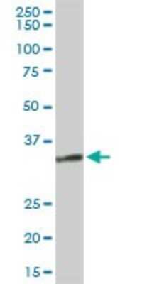 Western Blot: 11 beta-HSD1 Antibody [H00003290-D01P] - Analysis of HSD11B1 expression in human liver.