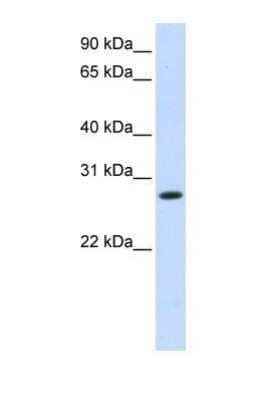 Western Blot: 11 beta-HSD1 Antibody [NBP1-69644] - 11 Beta HSD1 This Anti-HSD11B1 antibody was used in Western Blot of Fetal Liver tissue lysate at a concentration of 1ug/ml.