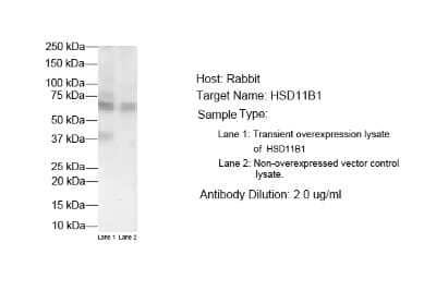 Western Blot: 11 beta-HSD1 Antibody [NBP1-69644] - Antibody Titration: 2 ug/ml Positive control: Transient overexpression lysate of HSD11B1 and Non-overexpressed vector control lysate.
