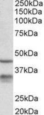 <b>Genetic Strategies Validation. </b>Western Blot: 11 beta-HSD1 Antibody [NBP2-27469] - (0.3 ug/ml) Analysis of Mouse Lung lysate (35 ug protein in RIPA buffer). Primary incubation was 1 hour. Detected by chemiluminescence.