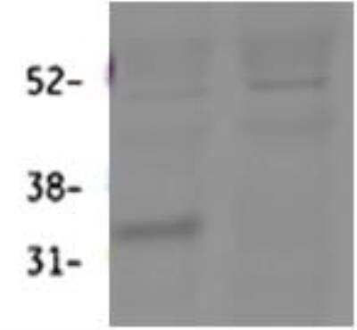 Western Blot: 11 beta-HSD1 Antibody [NBP2-27469] -  (0.3 ug/ml) Analysis of Mouse Lung lysate (60 ug protein in RIPA buffer). First lane shows wildtype and second lane shows knockout background. Primary incubation was overnight. Detected by fluorescence. Data obtained from Prof. K. Chapman and Zhenguang Zhang, Centre for Cardiovascular Sciences, Queen's Medical Research Institute, Edinburgh, UK