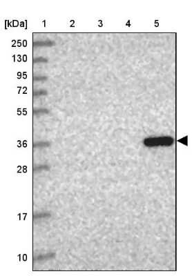 Western Blot: 11 beta-HSD1 Antibody [NBP2-48879] - Lane 1: Marker [kDa] 250, 130, 95, 72, 55, 36, 28, 17, 10Lane 2: Human cell line RT-4Lane 3: Human cell line U-251MG spLane 4: Human plasma (IgG/HSA depleted)Lane 5: Human liver tissue