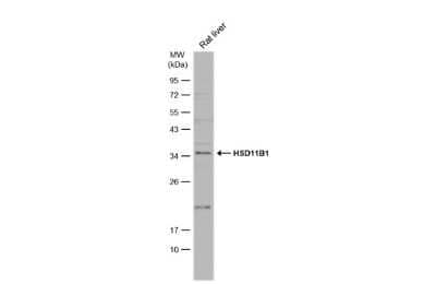 Western Blot: 11 beta-HSD1 Antibody [NBP3-13393] - Rat tissue extract (50 ug) was separated by 12% SDS-PAGE, and the membrane was blotted with 11 beta-HSD1 antibody (NBP3-13393) diluted at 1:1000. The HRP-conjugated anti-rabbit IgG antibody (NBP2-19301) was used to detect the primary antibody, and the signal was developed with Trident ECL plus-Enhanced.