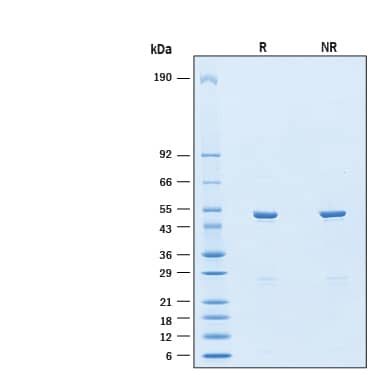 2 μg/lane of Recombinant SARS-CoV-2 P.1 Nucleocapsid His-tag Protein (Catalog # 11002-CV) was resolved with SDS-PAGE under reducing (R) and non-reducing (NR) conditions and visualized by Coomassie® Blue staining, showing bands at 45-55 kDa.