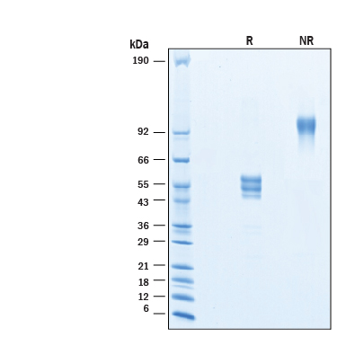 2 μg/lane of Recombinant Human VIPR2 Fc Chimera Protein (Catalog # 11003-VR) was resolved with SDS-PAGE under reducing (R) and non-reducing (NR) conditions and visualized by Coomassie® Blue staining, showing bands at 45-60 kDa and 90-120 kDa, respectively.