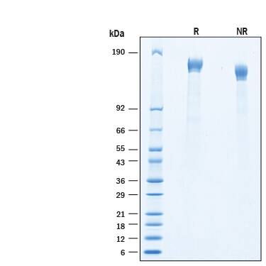 2 μg/lane of Recombinant SARS-CoV-2 C.1.2 Spike (GCN4-IZ) His-tag Protein (Catalog # 11007-CV) was resolved with SDS-PAGE under reducing (R) and non-reducing (NR) conditions and visualized by Coomassie® Blue staining, showing bands at 142-170 kDa.