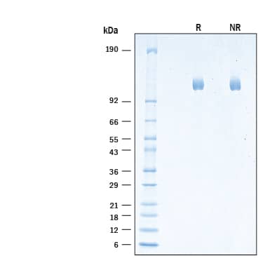 SDS-Page ITIH5 [Unconjugated]