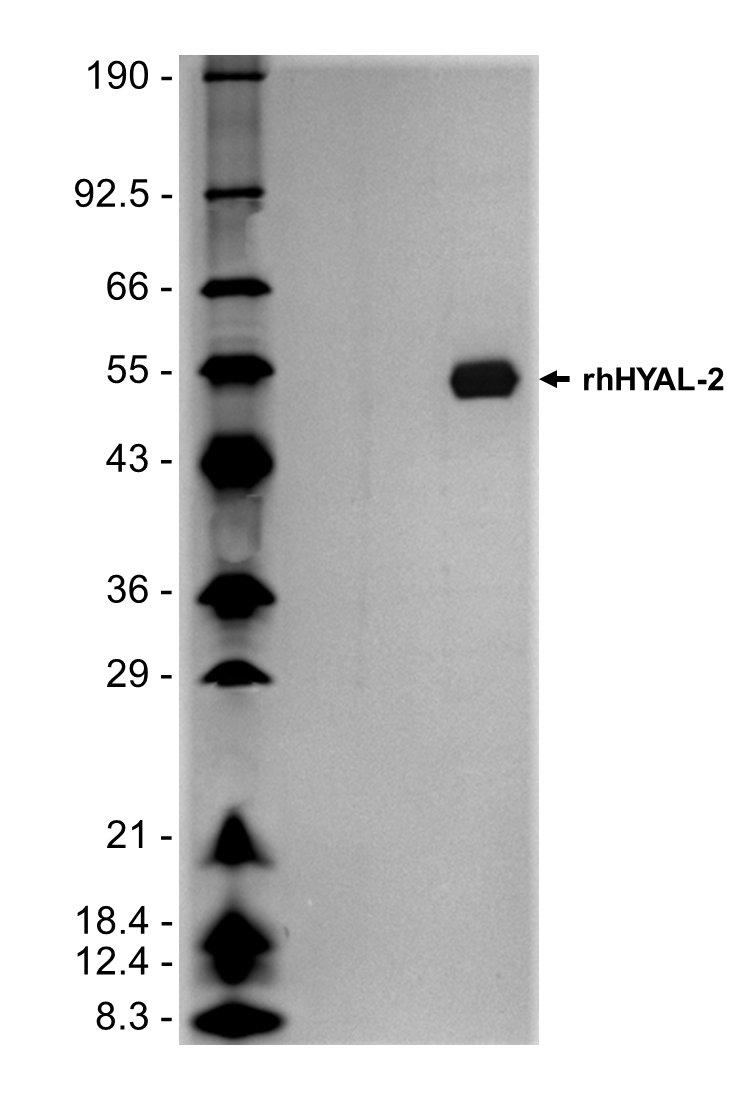 1 μg/lane of rhHYAL-2 (Catalog # 11012-GH) was resolved with SDS-PAGE under reducing (R) conditions and visualized by Silver Staining, showing a band at 55 kDa.