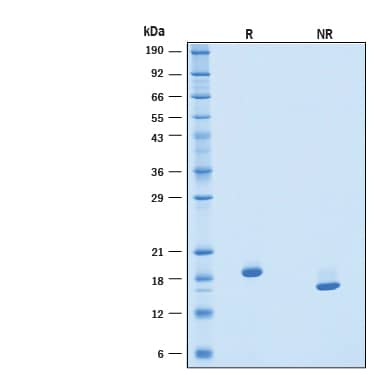 2 μg/lane of Recombinant Human IFN-alpha-1a Protein (Catalog # 11014-IF) was resolved with SDS-PAGE under reducing (R) and non-reducing (NR) conditions and visualized by Coomassie® Blue staining, showing bands at 17‑21 kDa.
