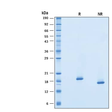 2 μg/lane of Recombinant Human Universal Type I IFN Protein (Catalog # 11020-IF) was resolved with SDS-PAGE under reducing (R) and non-reducing (NR) conditions and visualized by Coomassie® Blue staining, showing bands at 16-22 kDa.