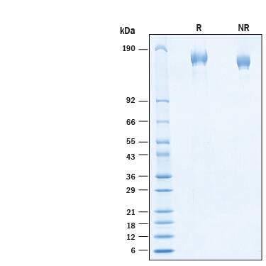 2 μg/lane of Recombinant SARS-CoV-2 R.1 S (GCN4-IZ) His-tag Protein (Catalog # 11026-CV) was resolved with SDS-PAGE under reducing (R) and non-reducing (NR) conditions and visualized by Coomassie® Blue staining, showing bands at 154-174 kDa.