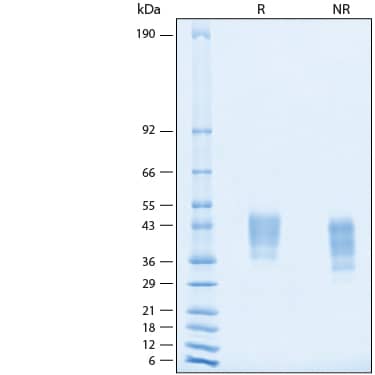 2 μg/lane of Recombinant Human IFN-gamma R1/CD119 His-tag Protein (Catalog # 11030-IR) was resolved with SDS-PAGE under reducing (R) and non-reducing (NR) conditions and visualized by Coomassie® Blue staining, showing bands at 36-46 kDa.