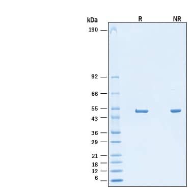 2 μg/lane of Recombinant SARS-CoV-2 Nucleocapsid His-tag Protein (Catalog # 11033-CV) was resolved with SDS-PAGE under reducing (R) and non-reducing (NR) conditions and visualized by Coomassie® Blue staining, showing bands at 45 - 55 kDa.