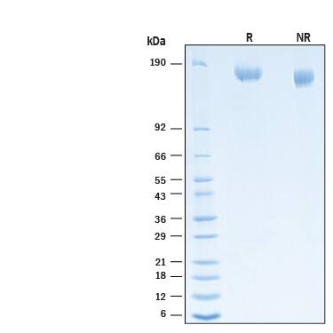 2 μg/lane of Recombinant SARS-CoV-2 B.1.1.529 Spike (GCN4-IZ) His-tag Protein (Catalog # 11061-CV) was resolved with SDS-PAGE under reducing (R) and non-reducing (NR) conditions and visualized by Coomassie® Blue staining, showing bands at 155-175 kDa.