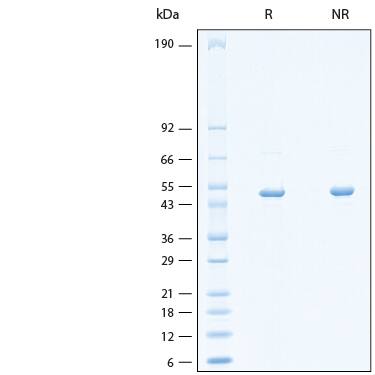 2 μg/lane of Recombinant SARS-CoV-2 P.2 Nucleocapsid His-tag Protein (Catalog # 11062-CV) was resolved with SDS-PAGE under reducing (R) and non-reducing (NR) conditions and visualized by Coomassie® Blue staining, showing bands at 45-55 kDa.