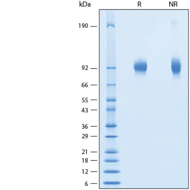 2 μg/lane of Recombinant Human gp130 His-tag Protein (Catalog # 11067-GP) was resolved with SDS-PAGE under reducing (R) and non-reducing (NR) conditions and visualized by Coomassie® Blue staining, showing bands at 86-100 kDa.