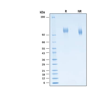 2 μg/lane of Recombinant SARS-CoV-2 B.1.1.529 Spike S1 Subunit His-tag Protein (Catalog # 11070-CV) was resolved with SDS-PAGE under reducing (R) and non-reducing (NR) conditions and visualized by Coomassie® Blue staining, showing bands at 104-116 kDa.