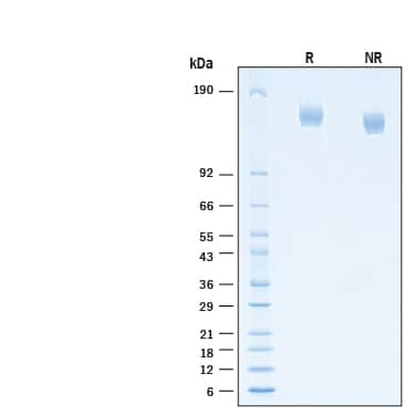 2 μg/lane of Recombinant SARS-CoV-2 B.1.630 Spike (GCN4-IZ) His-tag Protein (Catalog # 11071-CV) was resolved with SDS-PAGE under reducing (R) and non-reducing (NR) conditions and visualized by Coomassie® Blue staining, showing bands at 145-161 kDa.