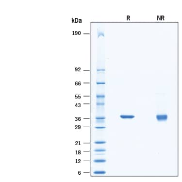 SDS-Page PRPS1 [Unconjugated]