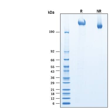 2 μg/lane of Recombinant Human SorLA His-tag Protein (Catalog # 11083-LA) was resolved with SDS-PAGE under reducing (R) and non-reducing (NR) conditions and visualized by Coomassie® Blue staining, showing bands at 270-345 kDa.