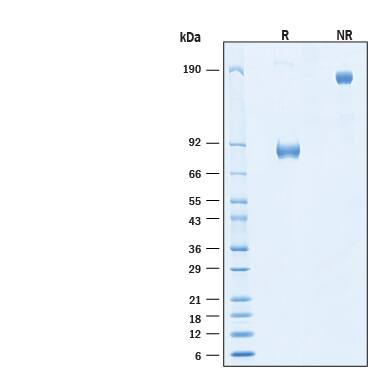 SDS-Page IL-1 RI [Unconjugated]