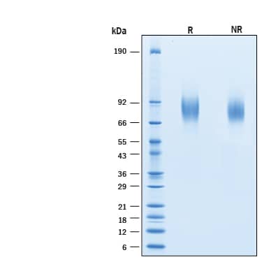 2 μg/lane of Recombinant Human CD44v5 His-tag Protein (Catalog # 11087-CD) was resolved with SDS-PAGE under reducing (R) and non-reducing (NR) conditions and visualized by Coomassie® Blue staining, showing bands at 76-86 kDa.
