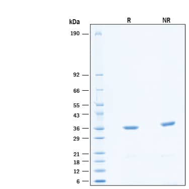 SDS-Page c-Abl [Unconjugated]