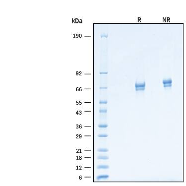 2 μg/lane of Recombinant Cynomolgus Monkey CD39/ENTPD1 His-tag Protein (Catalog # 11092-EN) was resolved with SDS-PAGE under reducing (R) and non-reducing (NR) conditions and visualized by Coomassie® Blue staining, showing bands at 60-77 kDa.