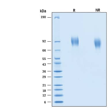 SDS-Page GUCY2C [Unconjugated]