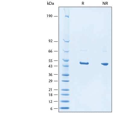 2 μg/lane of Recombinant SARS-CoV-2 B.1.1.529 N His-tag Protein (Catalog # 11099-CV) was resolved with SDS-PAGE under reducing (R) and non-reducing (NR) conditions and visualized by Coomassie® Blue staining, showing bands at 45-55 kDa.