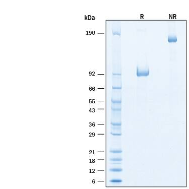 2 μg/lane of Recombinant Cynomolgus Monkey LILRB5/CD85c/LIR-8 Fc Chimera Protein (Catalog # 11102-T4) was resolved with SDS-PAGE under reducing (R) and non-reducing (NR) conditions and visualized by Coomassie® Blue staining, showing bands at 86-99 kDa and 170-200 kDa, respectively.