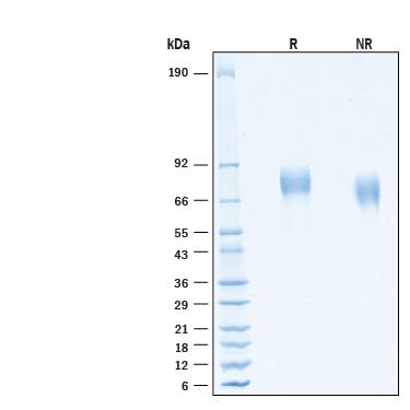 2 μg/lane of Recombinant Human FGFR1 alpha (IIIc) His-tag Protein (Catalog # 11118-FR) was resolved with SDS-PAGE under reducing (R) and non-reducing (NR) conditions and visualized by Coomassie® Blue staining, showing bands at 70-85 kDa.