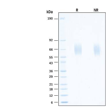 2 μg/lane of Recombinant Human FGFR2 alpha (IIIc) His-tag Protein (Catalog # 11119-FR) was resolved with SDS-PAGE under reducing (R) and non-reducing (NR) conditions and visualized by Coomassie® Blue staining, showing bands at 58-72 kDa.