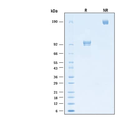 2 μg/lane of Recombinant Cynomolgus Monkey MuSK Fc Chimera Protein (Catalog # 11122-MK) was resolved with SDS-PAGE under reducing (R) and non-reducing (NR) conditions and visualized by Coomassie® Blue staining, showing bands at 85-105 kDa and 170-210 kDa, respectively.