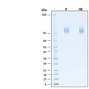 2 μg/lane of Recombinant SARS-CoV-2 B.1.617.2 Spike S1 Subunit His-tag Protein (Catalog # 11132-CV) was resolved with SDS-PAGE under reducing (R) and non-reducing (NR) conditions and visualized by Coomassie® Blue staining, showing bands at 100-110 kDa.