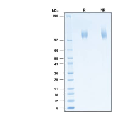 2 μg/lane of Recombinant SARS-CoV-2 B.1.351 Spike S1 Subunit His-tag Protein (Catalog # 11133-CV) was resolved with SDS-PAGE under reducing (R) and non-reducing (NR) conditions and visualized by Coomassie® Blue staining, showing bands at 102-112 kDa.