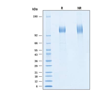 2 μg/lane of Recombinant SARS-CoV-2 P.1 Spike S1 Subunit His-tag Protein (Catalog # 11138-CV) was resolved with SDS-PAGE under reducing (R) and non-reducing (NR) conditions and visualized by Coomassie® Blue staining, showing bands at 100 - 120 kDa.