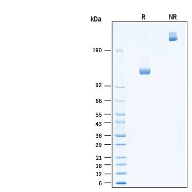 SDS-Page DPPIV/CD26 [Unconjugated]