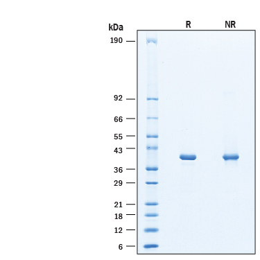 2 μg/lane of Recombinant Human EGFR Kinase Domain His-tag Protein (Catalog # 11142-ER) was resolved with SDS-PAGE under reducing (R) and non-reducing (NR) conditions and visualized by Coomassie® Blue staining, showing bands at 39 kDa.