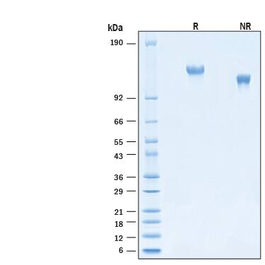 2 μg/lane of Recombinant Cynomolgus Monkey LDLR His-tag Protein (Catalog # 11151-LD) was resolved with SDS-PAGE under reducing (R) and non-reducing (NR) conditions and visualized by Coomassie® Blue staining, showing bands at 125-140 kDa.