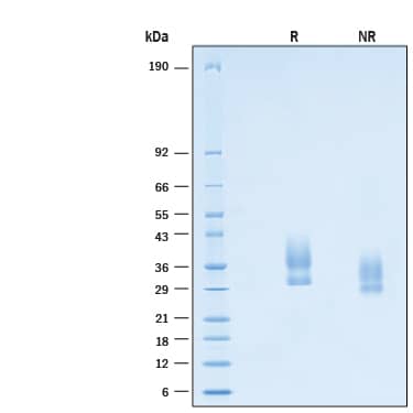 2 μg/lane of Recombinant Cynomolgus Monkey Lymphotoxin  beta R/TNFRSF3 His-tag Protein (Catalog # 11152-LR) was resolved with SDS-PAGE under reducing (R) and non-reducing (NR) conditions and visualized by Coomassie® Blue staining, showing bands at 29-41 kDa.