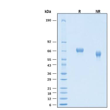 2 μg/lane of Recombinant Cynomolgus Monkey MuSK His-tag Protein (Catalog # 11153-MK) was resolved with SDS-PAGE under reducing (R) and non-reducing (NR) conditions and visualized by Coomassie® Blue staining, showing bands at 60-70 kDa.
