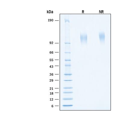 2 μg/lane of Recombinant Human TIM‑1/KIM‑1/HAVCR His-tag Protein (Catalog # 11157-TM) was resolved with SDS-PAGE under reducing (R) and non-reducing (NR) conditions and visualized by Coomassie® Blue staining, showing bands at 105-125 kDa.