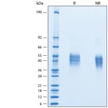 2 μg/lane of Recombinant Human TROP-2 His-tag Protein (Catalog # 11158-T2) was resolved with SDS-PAGE under reducing (R) and non-reducing (NR) conditions and visualized by Coomassie® Blue staining, showing bands at 32-57 kDa.
