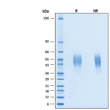 2 μg/lane of Recombinant Human IL-4R alpha His-tag Protein (Catalog # 11165-4R) was resolved with SDS-PAGE under reducing (R) and non-reducing (NR) conditions and visualized by Coomassie® Blue staining, showing bands at 49-58 kDa.