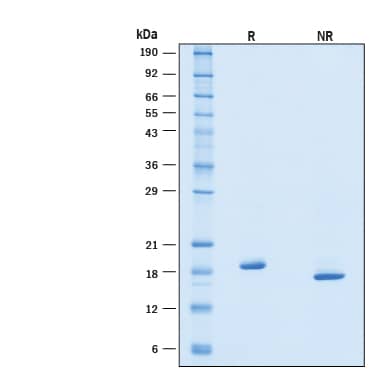 2 μg/lane of Recombinant Human IFN-alpha 6/IFNA6 Protein (Catalog # 11168-IF) was resolved with SDS-PAGE under reducing (R) and non-reducing (NR) conditions and visualized by Coomassie® Blue staining, showing bands at 18-22 kDa.