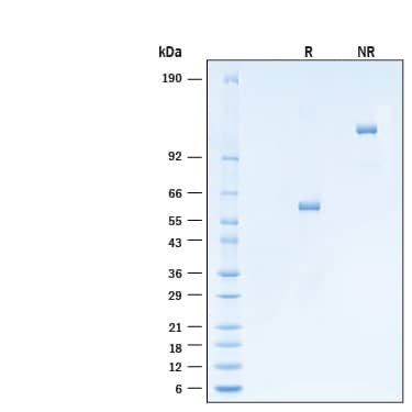 2 μg/lane of Recombinant Cynomolgus Monkey/Rhesus Macaque VSIG8 Fc Chimera Protein (Catalog # 11172-VS) was resolved with SDS-PAGE under reducing (R) and non-reducing (NR) conditions and visualized by Coomassie® Blue staining, showing bands at 56-63 kDa and 110-130 kDa, respectively.
