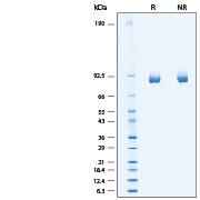 2 μg/lane of Recombinant Human alpha-L-Iduronidase/IDUA His-tag Protein (Catalog # 11180-GH) was resolved with SDS-PAGE under reducing (R) and non-reducing (NR) conditions and visualized by Coomassie® Blue staining, showing bands at 80-88 kDa.